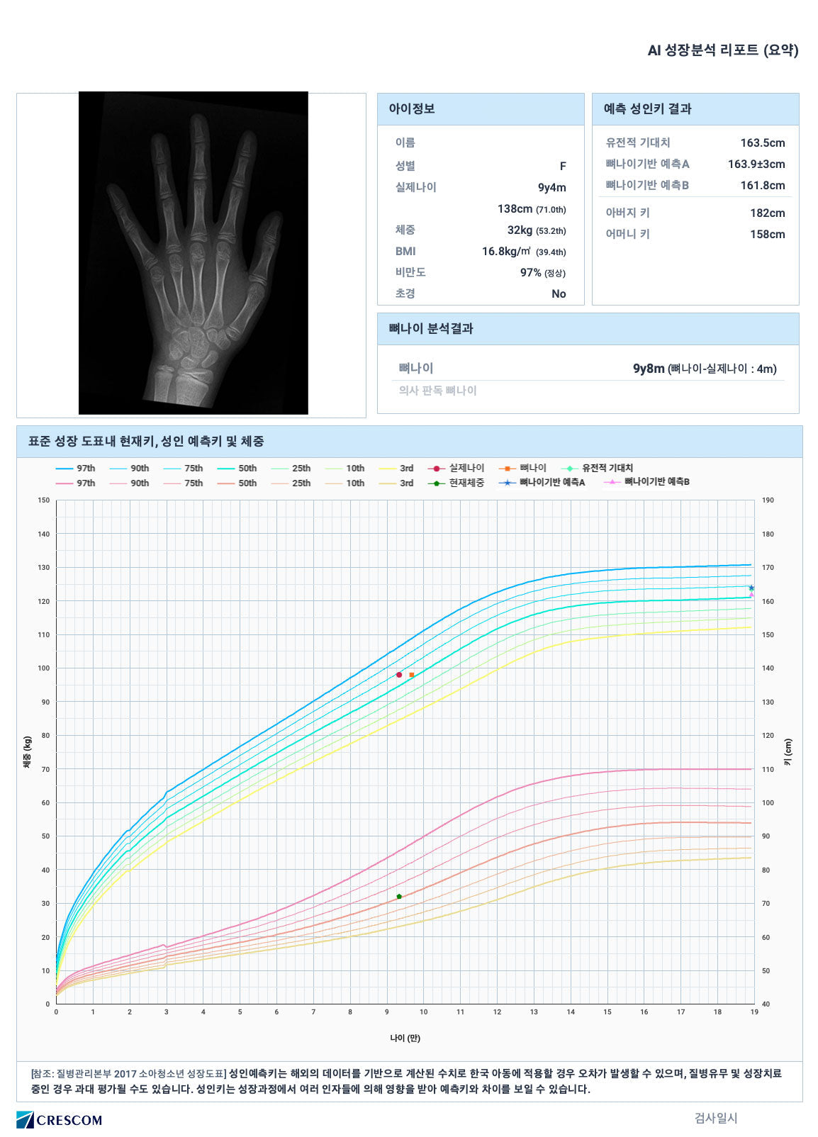 Bone Age and Adult Height Prediction